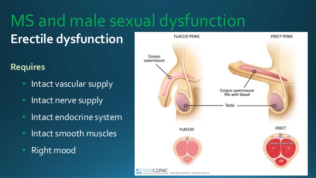  Male Sexual Dysfunction