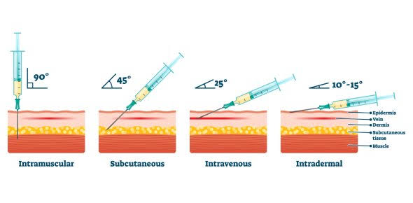 Injections