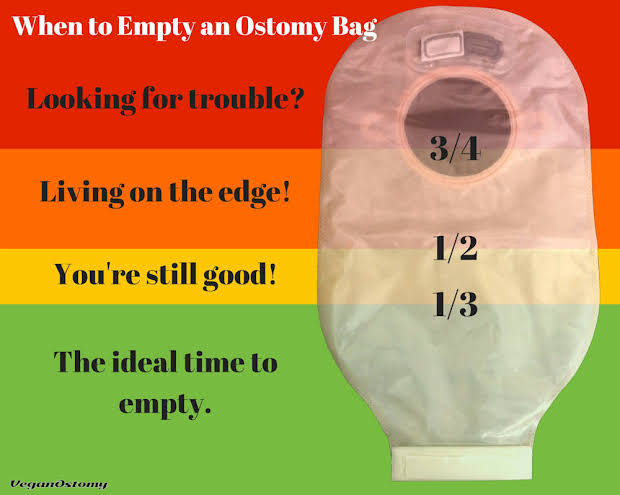 Ostomy bag